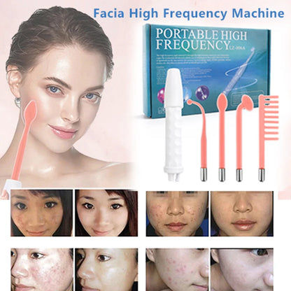 High Frequency Facial Machine Electrotherapy